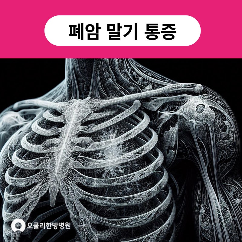 폐암 말기 통증 원인 및 생존기간 늘리는 치료방법