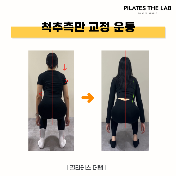  목동 필라테스 척추측만증 교정 운동 후기