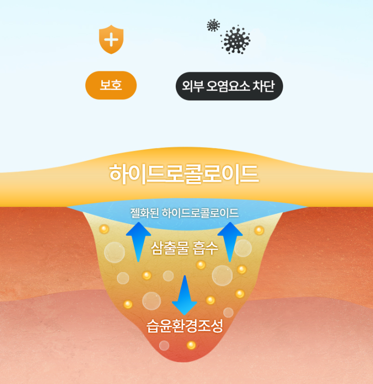  여드름패치 원리 하이드로콜로이드 교체 간격