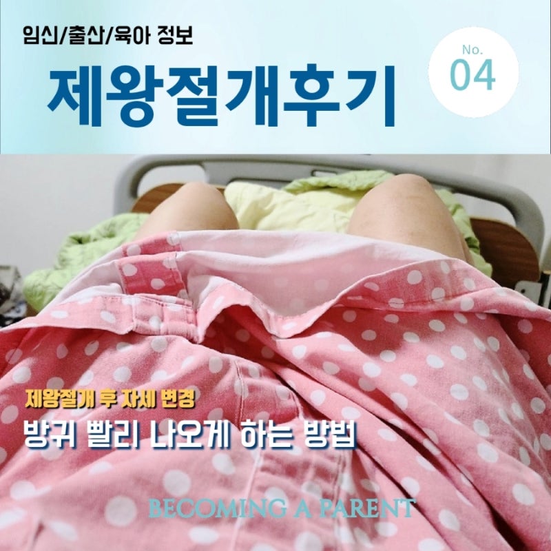 [출산] 제왕절개후기 - 빨리 회복하기 / 제왕절개 후 자세 변경 / 수술 후 방귀 빨리 나오게 하....