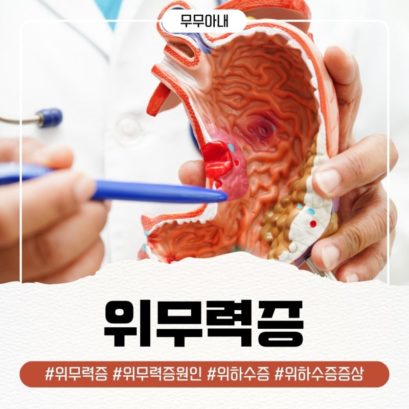 위무력증 위하수증 증상 원인 치료방법