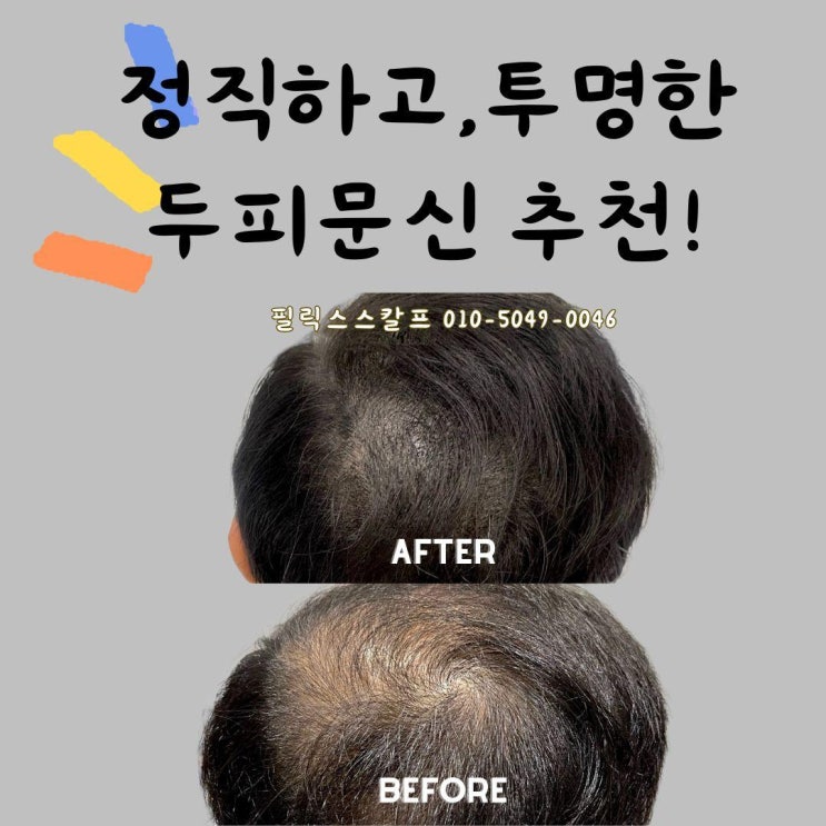  검단두피문신의 새로운 기준, 두피문신후기로 증명합니다.