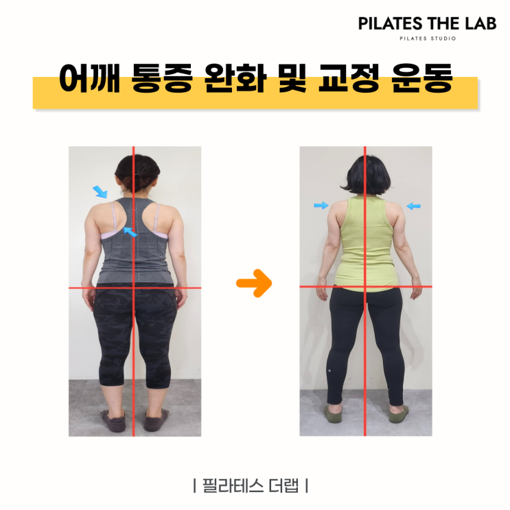  목동 필라테스 어깨 통증 완화 및 교정 운동 후기