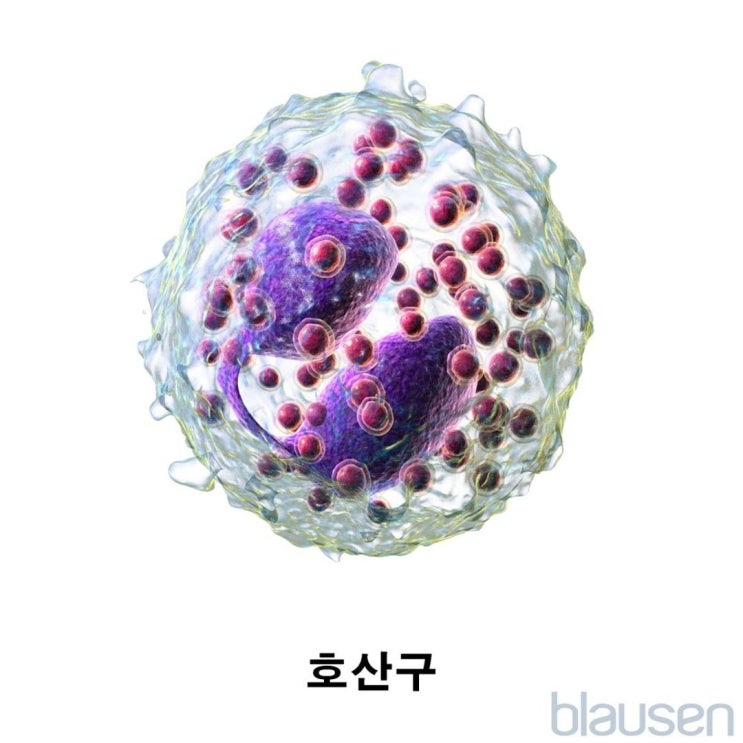 높은 백혈구 수치(백혈구 증가증)