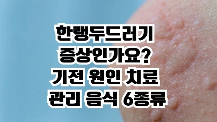  한랭두드러기증상 두드러기 기전 원인 치료 관리 음식6