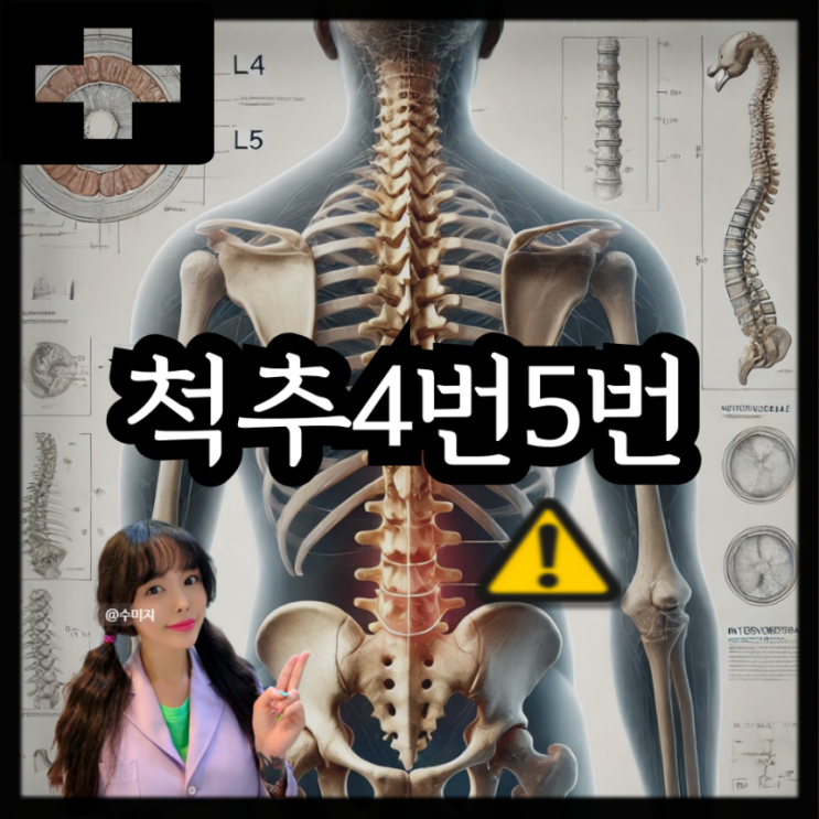  척추 4번 5번 척추 디스크 증상 통증 방사통 하지방사통
