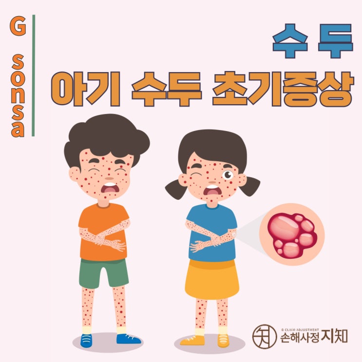  아기 수두 초기증상, 전염부터 법정전염병 진단비까지 꼭 알아야 할 모든 것 - [의학 정보, BoDa]