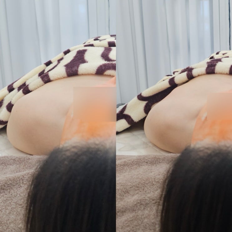  대구 달서구 에스테틱 블랙헤드 압출 물오른피부 신월성점