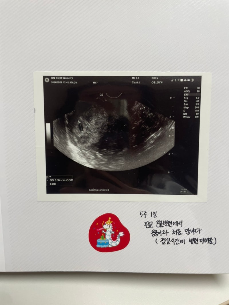 임신 초기 중기 후기 여정 기록 with 강남차병원 박희진 교수님