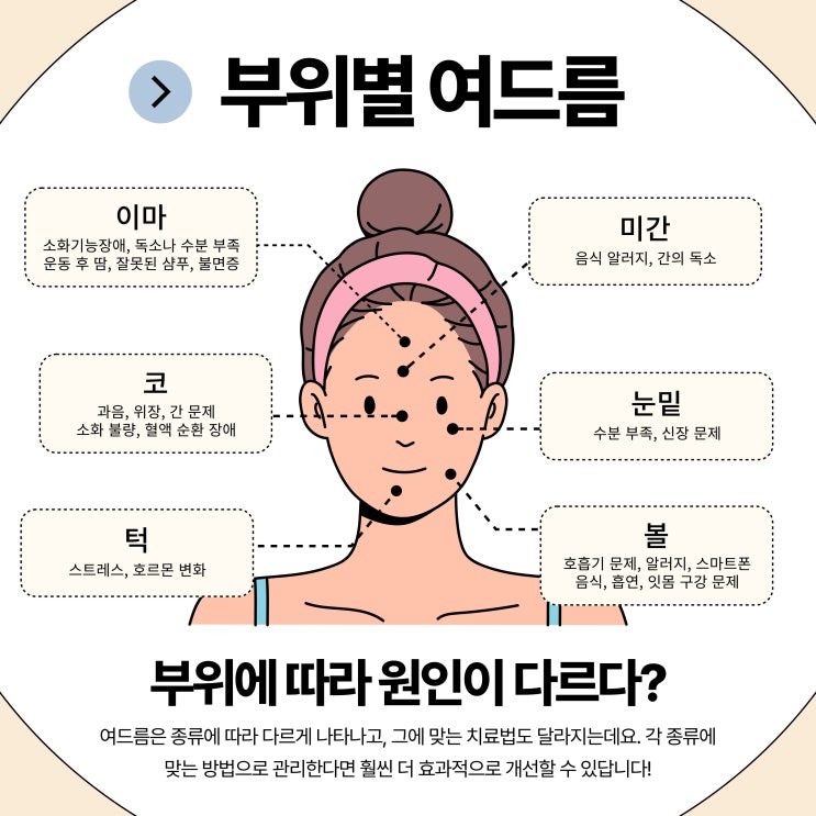  불광역피부과 여드름 치료의 최적기, 새해 목표는 피부관리!