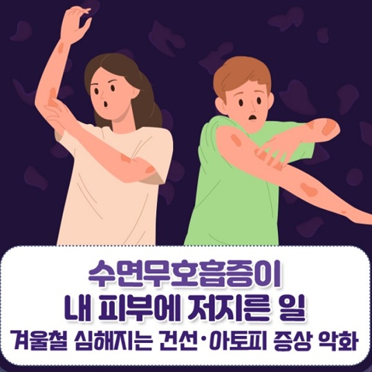  수면 무호흡증이 내 피부에 저지른 일 #겨울아토피피부염 #겨울건선