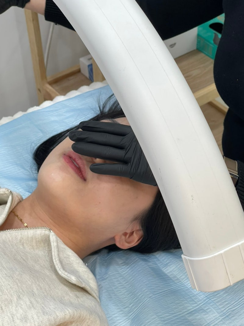 전주 비립종 제거 잘하는 ‘뷰클린’ 예약 잡기 힘들었다..