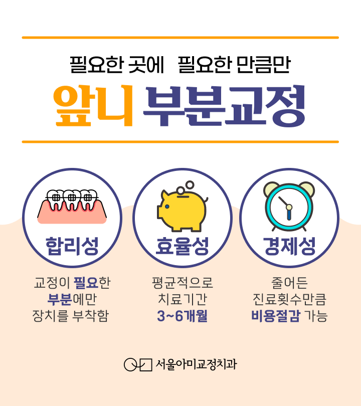  송도부분교정 특징과 장치에 대해 알아보기