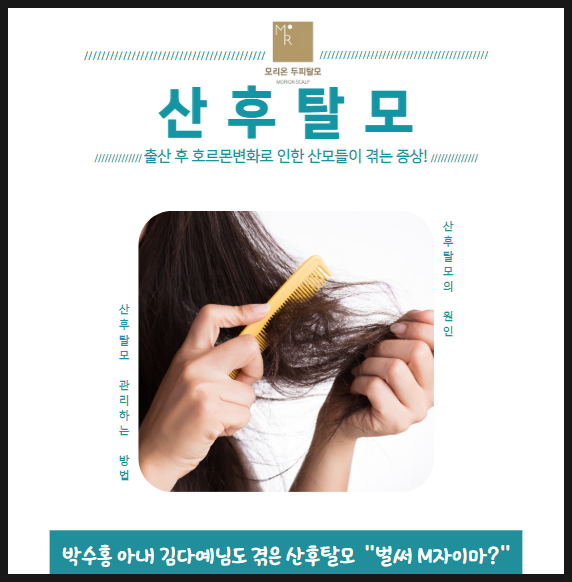 <b>박수홍</b> 아내 <b>김다예</b>, "벌써 M자 탈모?"