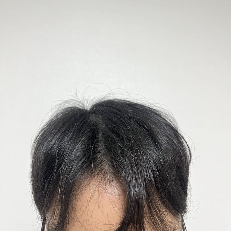  온유 비오틴 추천 탈모영양제 온유비오틴