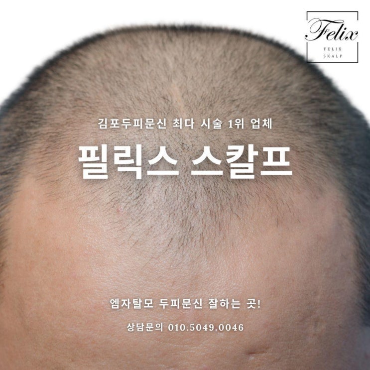  풍무동두피문신 여러분들의 탈모고민을 깊이 이해합니다.