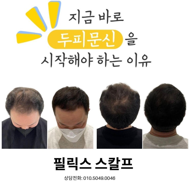  2025년 구래동두피문신 전문 필릭스 스칼프에서 탈모정보 받아가세요