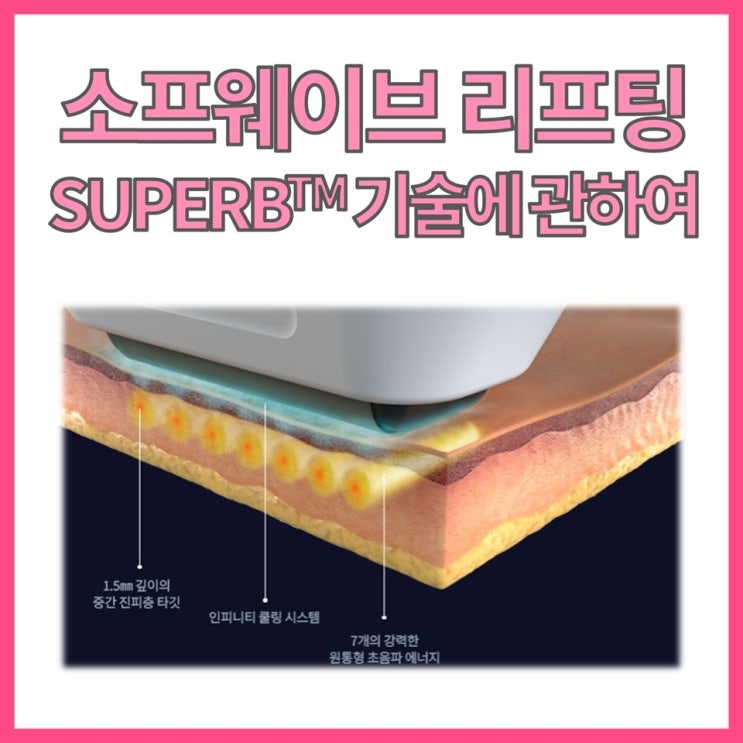  오랜만에 인사드려요! 소프웨이브(Sofwave)의 SUPERB기술과, 꾸준한 경험이 만드는 차이