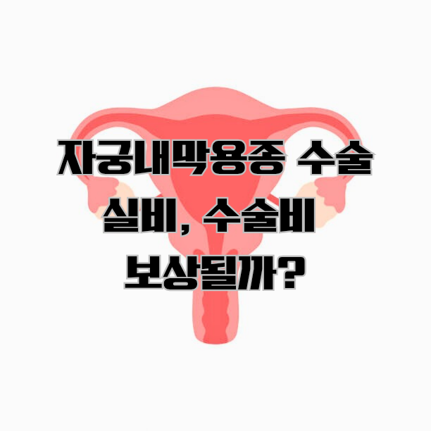 자궁폴립 원인, 증상, 수술!? 자궁폴립제거술 실비, 수술비도 알아보자!