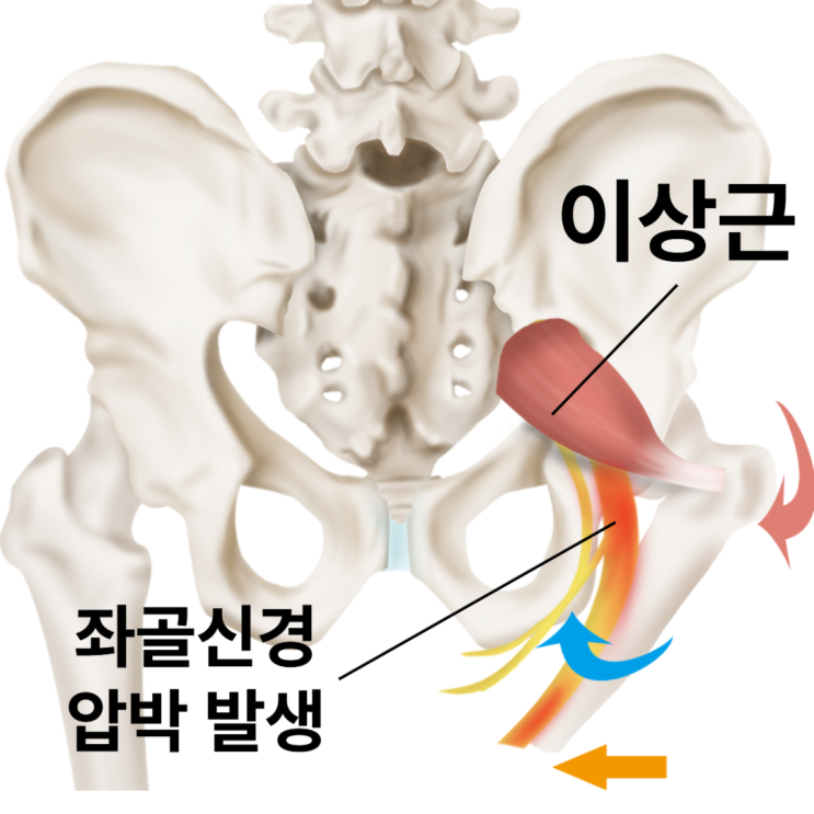  부산 동래 이상근증후군, 근본적인 구조적 기능적 문제를 해결해야 합니다.