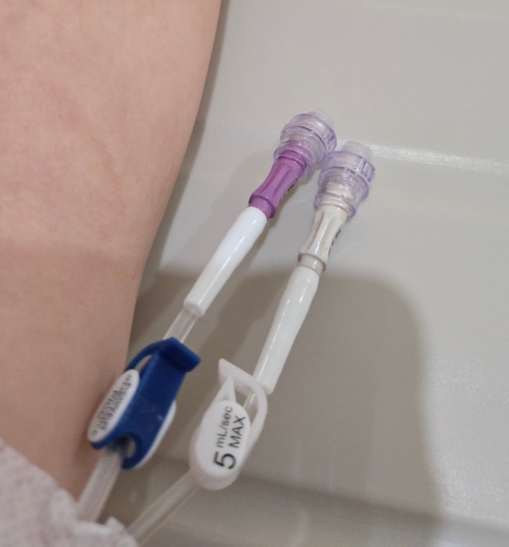  PICC 중심정맥관 시술 삽입 제거 후기 : 통증 사람마다 다르더라 (담낭제거 부작용)