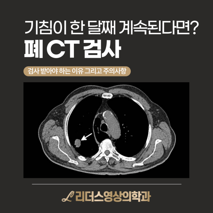  기침이 한 달째 계속된다면? X-ray로 안 보이면, 폐 CT가 필요할 수 있어요