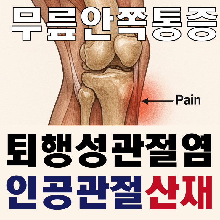  [무릎 안쪽 통증] 퇴행성 관절염 인공관절 수술 산재 신청 절차