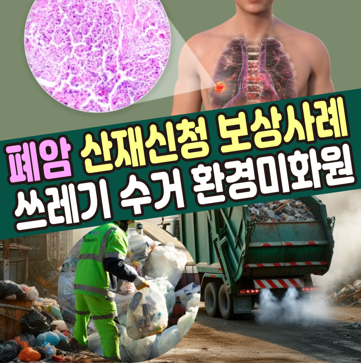  [대구 산재 노무사] 폐암 산재신청 보상사례 (쓰레기 수거 환경미화원)