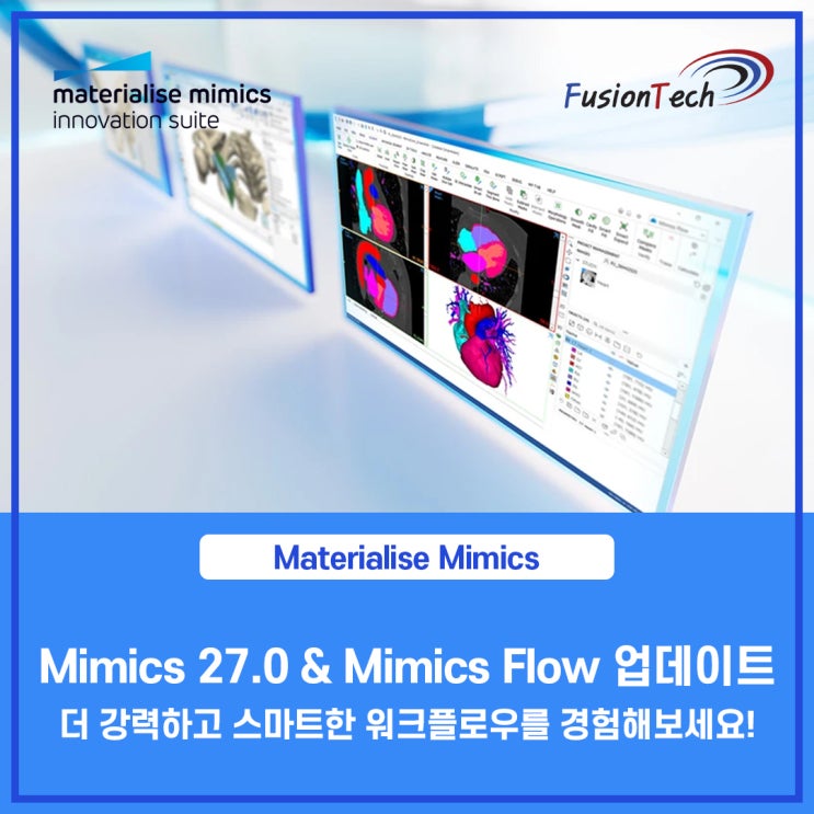  [Materialise S/W] Mimics 27.0 & Flow 업데이트 소식