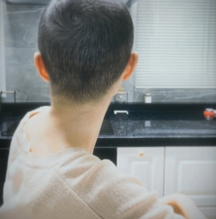 박성광 아내 <b>이솔이</b>, <b>암투병</b>으로 삭발한 머리 공개?