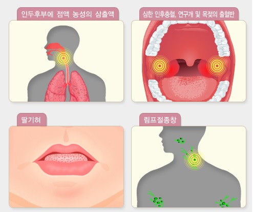  광주광역시, 성홍열 검출률 급증 손 씻기 등 개인위생 철저히 해야... [한국철도일보]