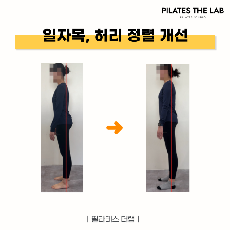  목동 필라테스 후기 : 일자목, 골반 전방 경사 교정으로 통증 잡은 20대 여성의 체형 변화 이야기