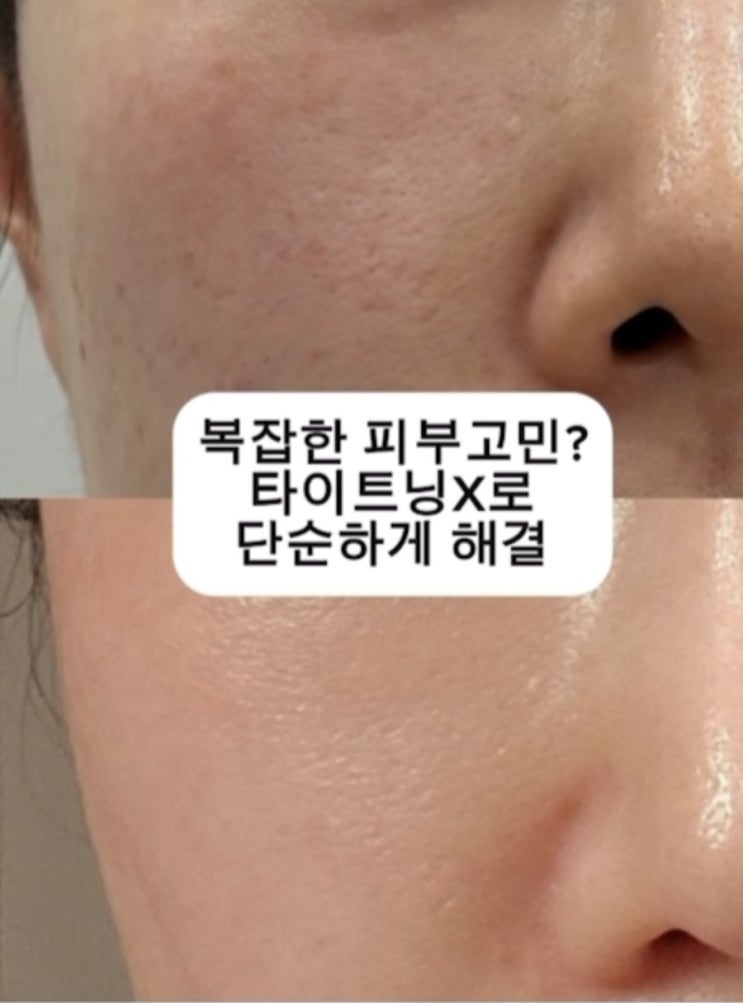  [대구 피부관리] 피부 고민, 아미뷰티에서 한번에 해결! 모공, 탄력부터 미백까지"