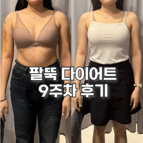  지방추출주사 9주 팔뚝 후기 정리