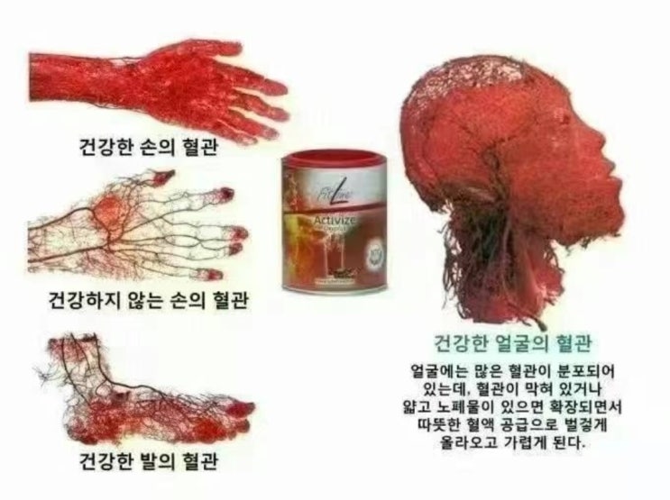  중국가짜음식, 가짜영양제 실태 독일 PM 쥬스를 먹어야하는 이유.