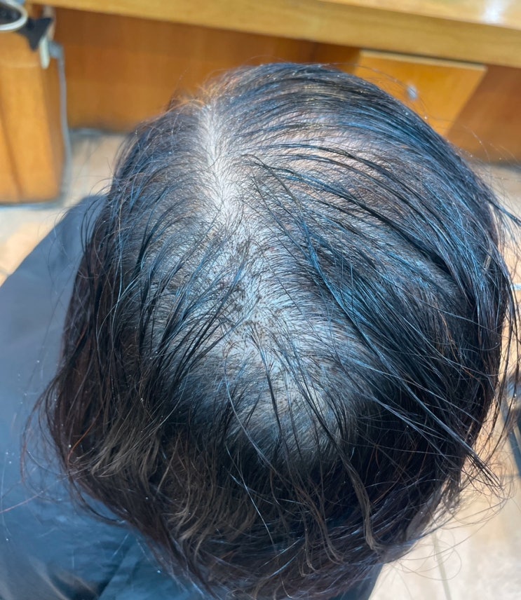  사상구에서왔다구요? 심한여성탈모 더이상방법이없다 부산르네시떼미용실탈모커버펌 전원일치 엄지척/ 괘법덕천화명명지모라구덕녹산용원김해울산양산밀양창원마산장유기장정관에코델타신항감만센텀대연