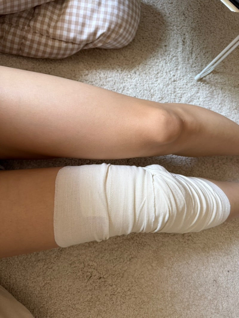 러닝 후 무릎 통증, 무릎 염증으로 병원 가서 물 빼고 온 후기