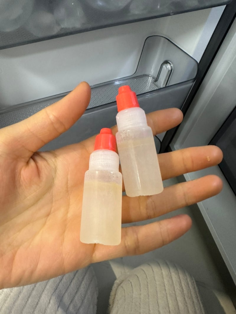 대전 밝은누리안과에서 스마일라식 한 후기