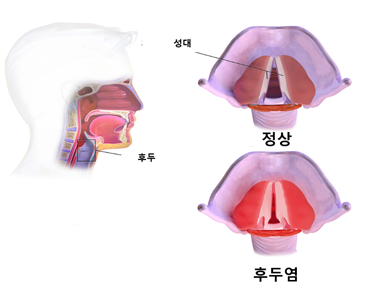 급성<b>후두염</b> <b>전현무</b>, 산송장... 목소리 안 나와"(<b>나혼산</b>)[...