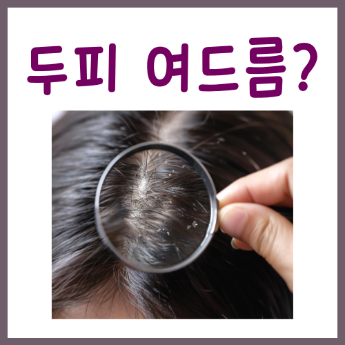  두피 여드름 원인? 이유를 모른다면 점검해야 할 '이것'