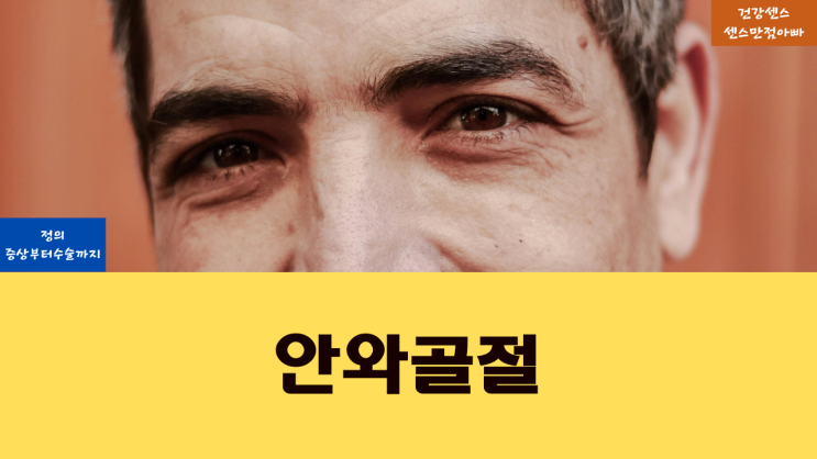  안와골절이란? 증상부터 수술까지
