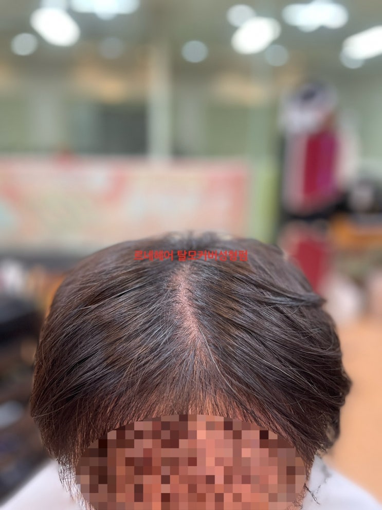  남구에서왔다구요!남자엠자넓은이마정수리탈모고민 탈모커버펌으로 고민싹뚝!/부산미용실르네시떼6층헤어샵[남구북구사상구동래구영도구화명동김해시해운대구진구정관서구동구중구거제양산밀양경주경남경북]