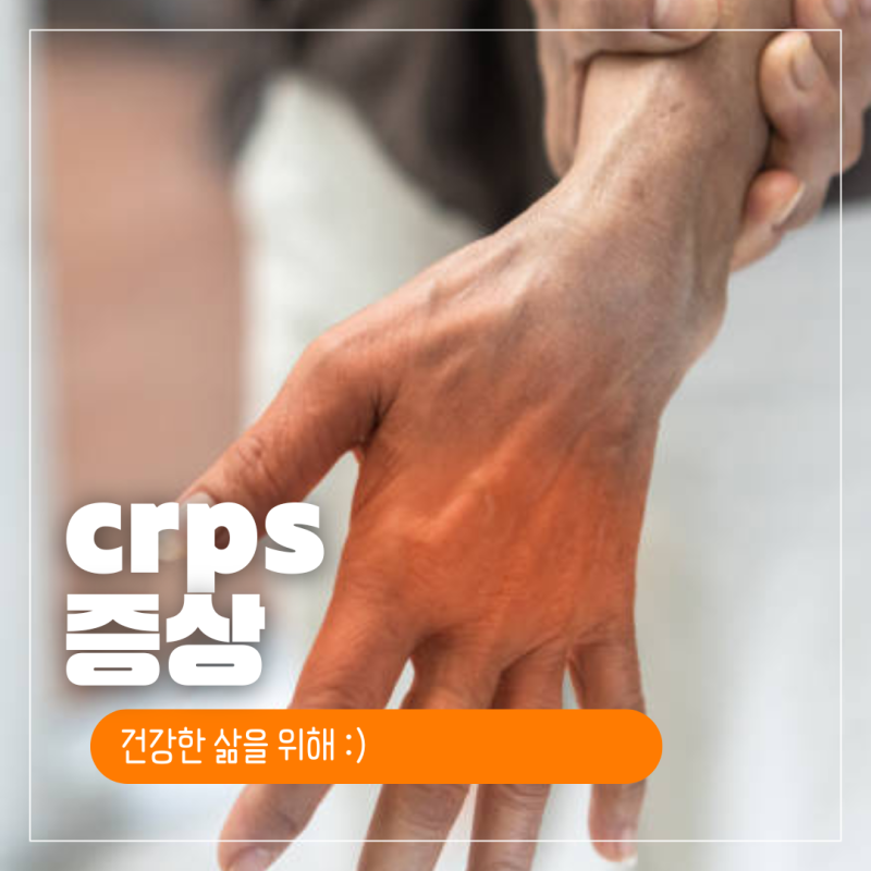 crps 초기증상 원인 증상 완치 crps 뜻