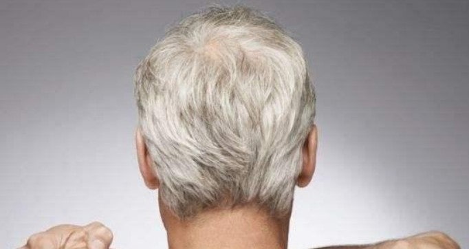 흰머리 꿈 해몽: 흰머리 나는 꿈, 흰머리 뽑는 꿈, 흰머리가 많은 꿈