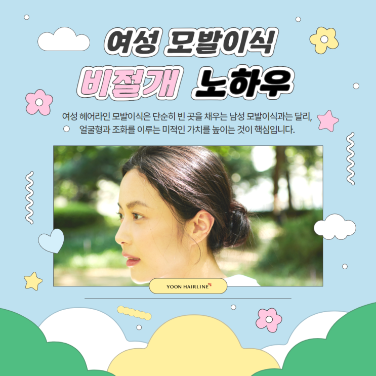 자연스러운 헤어라인 완성! 여성 맞춤형 비절개 모발이식