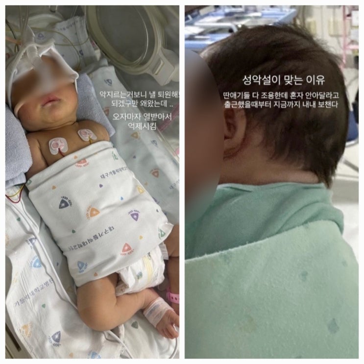 신생아 학대 논란 간호사 대구경찰 집 휴대폰 압수수색 신생아 학대 논란 간호사 대구경찰 집 휴대폰 압수수색