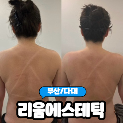 [부산/다대포] 다대포피부관리 순환관리로 유명한 "리움에스테틱" 등관리 솔직후기