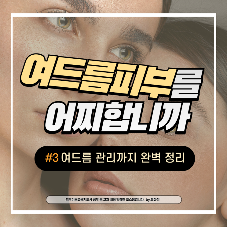  턱 이마 화농성 여드름 종류 원인 예방법 주의사항 완벽 정리
