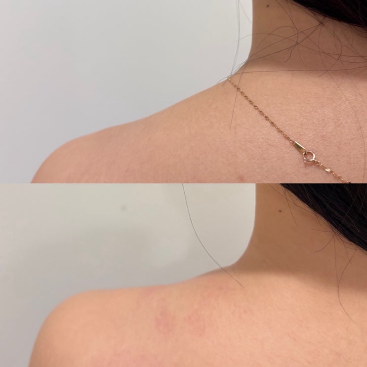  상무지구 다이어트 14일동안 광주상무점 셀롤리온 칼로리바