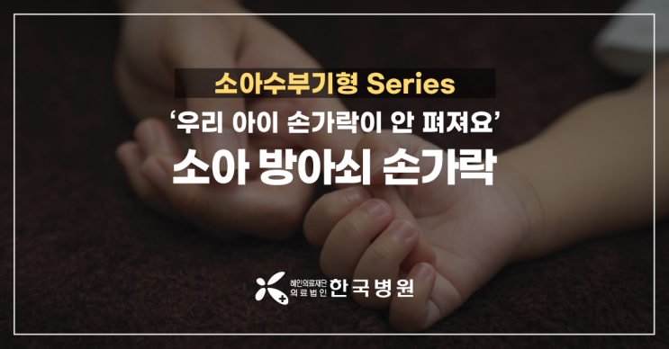  제주 정형외과_아이 손가락이 안 펴져요!···소아 방아쇠수지증후군군, 심하면 수술까지?